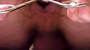 Garden briar enema and anal distension