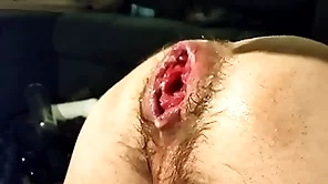 Just fisting my loose hole with the addition of prolapse:)