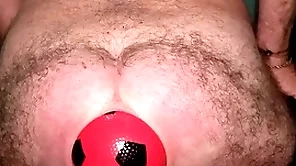 Globe record 13 cm wide anal stretching with inflatable ball.
