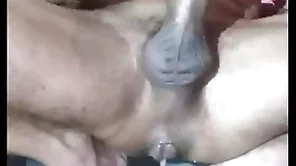 Incredibil react prostate anal height