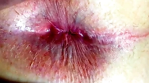 Arse and anus closeup