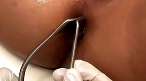 Asian patient penetrated yon anal crevice by stud yon missionary